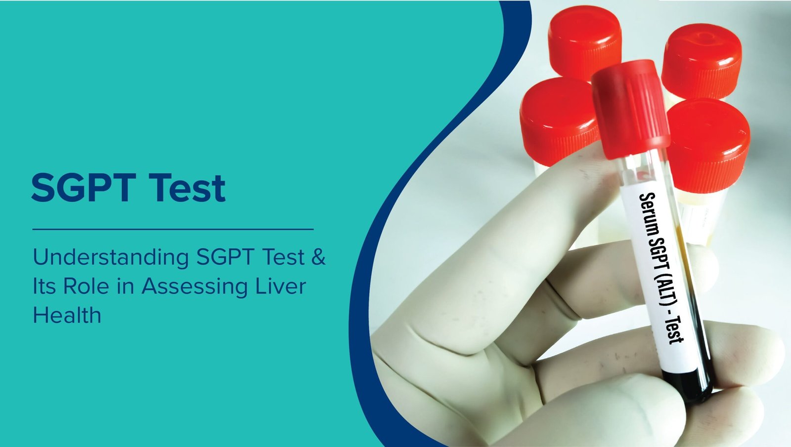 liver function test explained